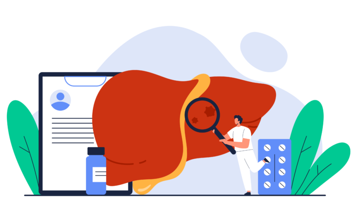Lakossági tájékoztató – Hepatitis A megbetegedések megelőzése