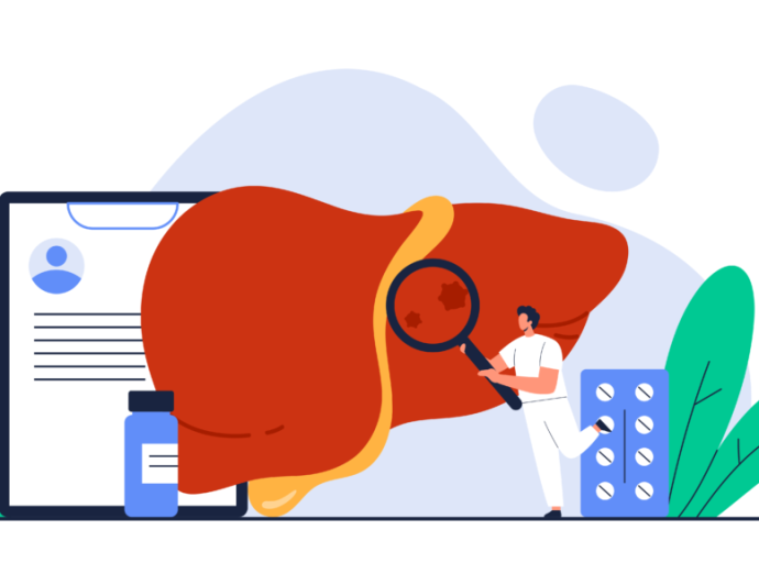 Lakossági tájékoztató – Hepatitis A megbetegedések megelőzése